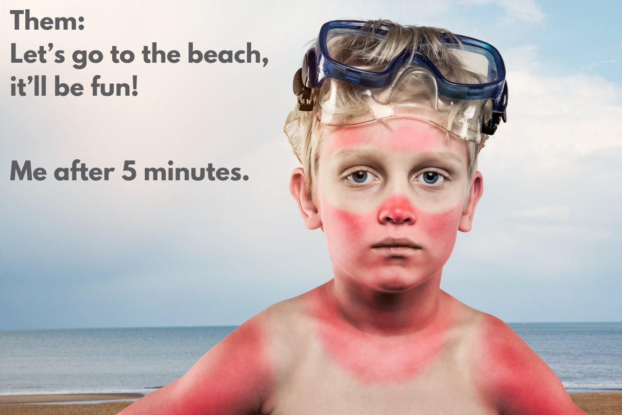 Kid with sunburn